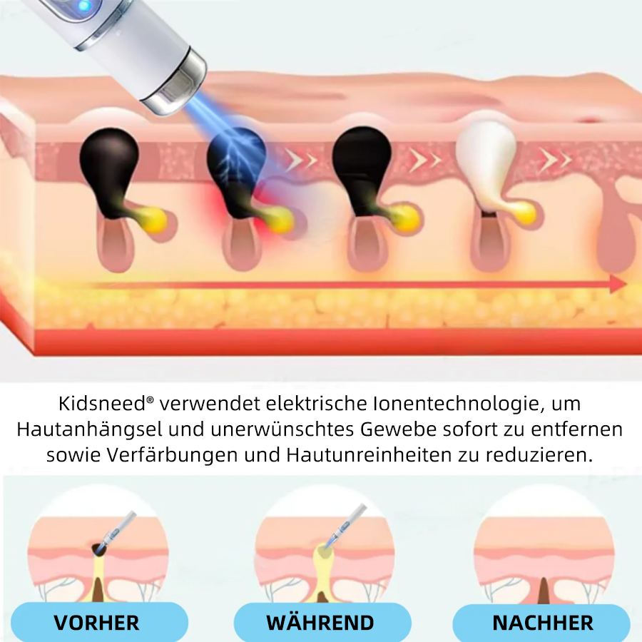 🎁Glückwunsch! Du bist einer unserer glücklichen Gewinner! 💪 Als unser exklusiver Glücksstern erhalten Sie jetzt einen unglaublichen Rabatt von 70%! Verpassen Sie nicht diese einmalige Gelegenheit, sich etwas Besonderes zu gönnen! 🛍️💫