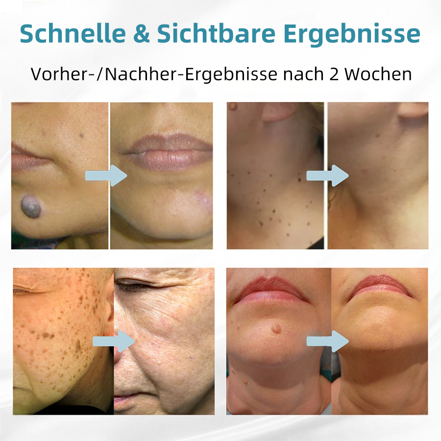 🎁Glückwunsch! Du bist einer unserer glücklichen Gewinner! 💪 Als unser exklusiver Glücksstern erhalten Sie jetzt einen unglaublichen Rabatt von 70%! Verpassen Sie nicht diese einmalige Gelegenheit, sich etwas Besonderes zu gönnen! 🛍️💫