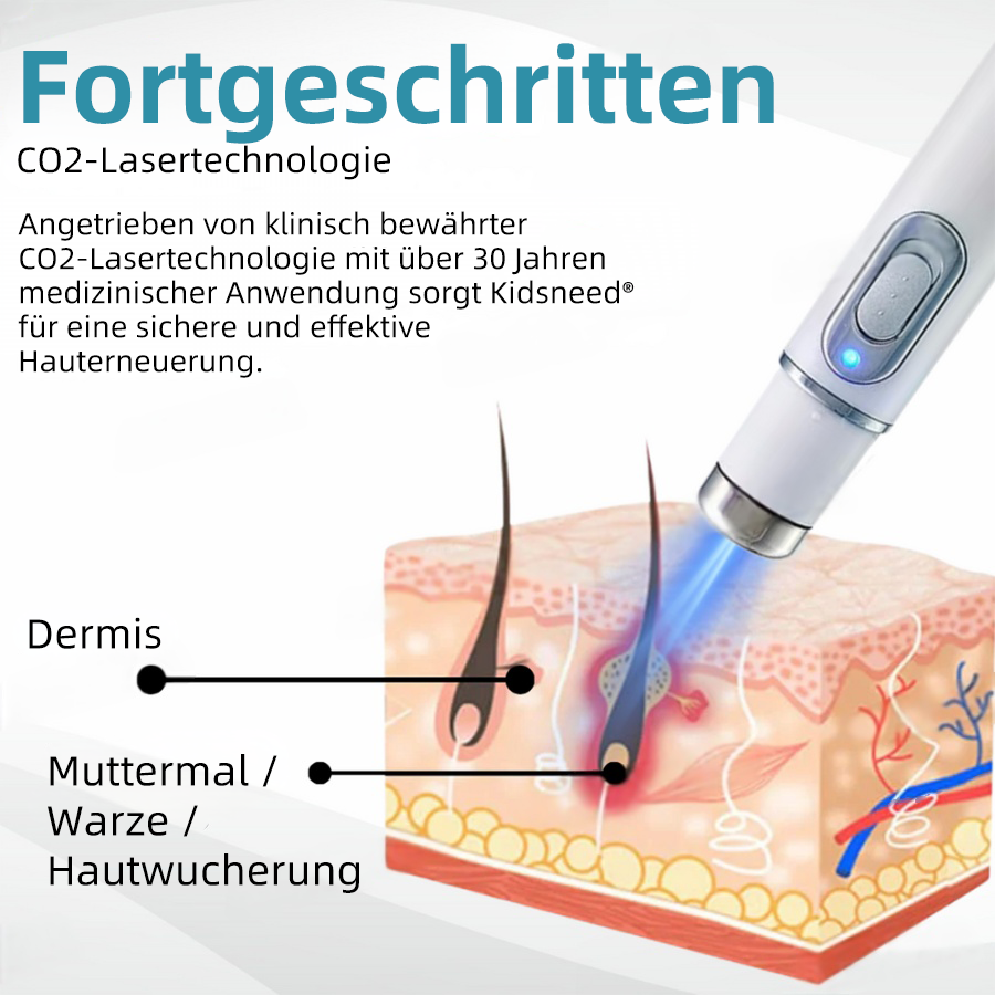 🎁Glückwunsch! Du bist einer unserer glücklichen Gewinner! 💪 Als unser exklusiver Glücksstern erhalten Sie jetzt einen unglaublichen Rabatt von 70%! Verpassen Sie nicht diese einmalige Gelegenheit, sich etwas Besonderes zu gönnen! 🛍️💫