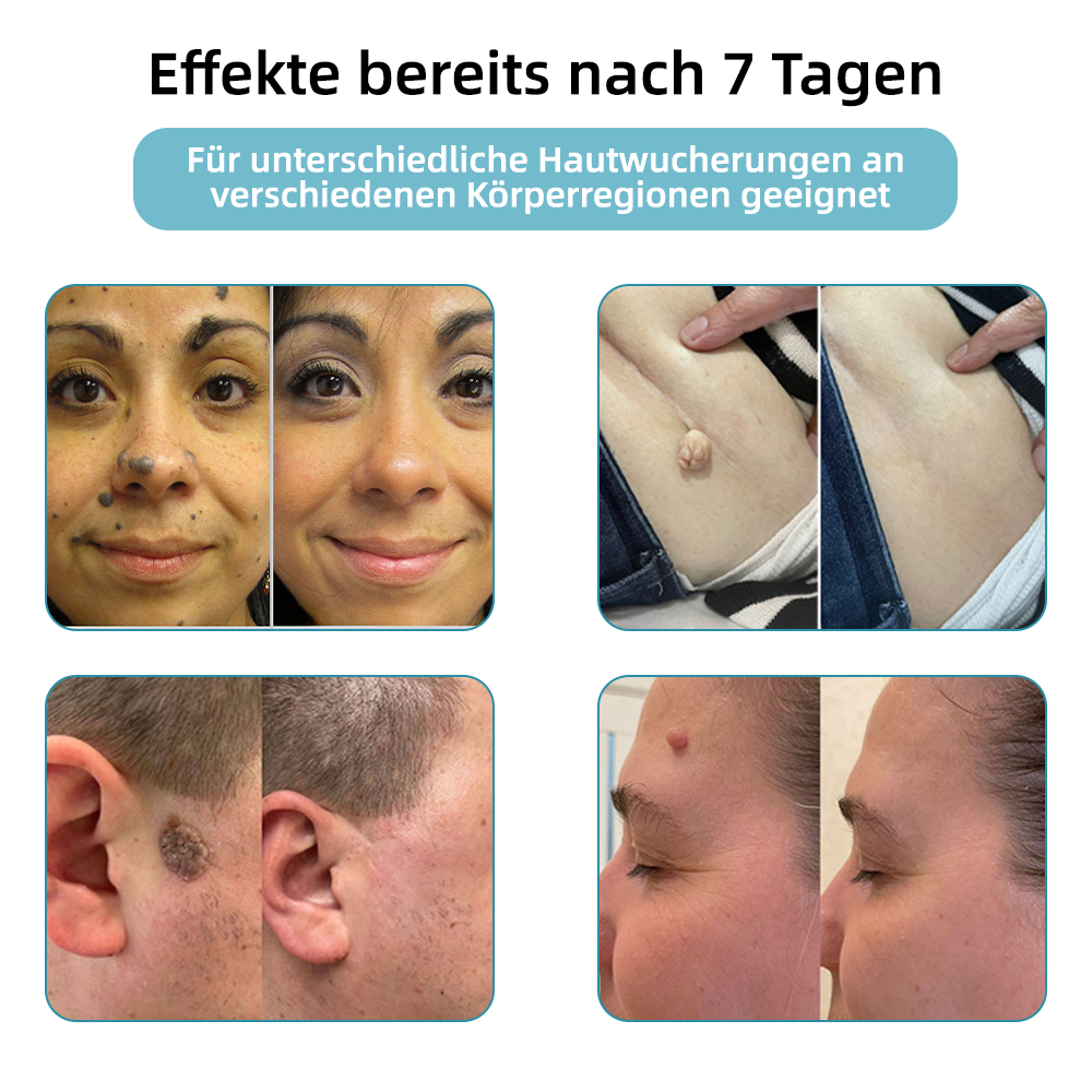 🎁Glückwunsch! Du bist einer unserer glücklichen Gewinner! 💪 Als unser exklusiver Glücksstern erhalten Sie jetzt einen unglaublichen Rabatt von 70%! Verpassen Sie nicht diese einmalige Gelegenheit, sich etwas Besonderes zu gönnen! 🛍️💫
