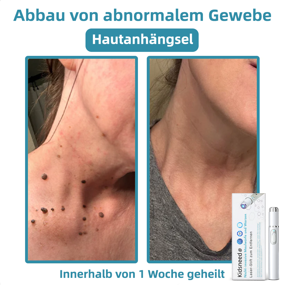 🎁Glückwunsch! Du bist einer unserer glücklichen Gewinner! 💪 Als unser exklusiver Glücksstern erhalten Sie jetzt einen unglaublichen Rabatt von 70%! Verpassen Sie nicht diese einmalige Gelegenheit, sich etwas Besonderes zu gönnen! 🛍️💫