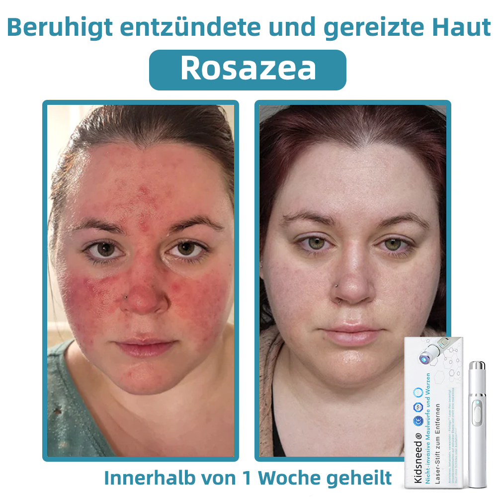 🎁Glückwunsch! Du bist einer unserer glücklichen Gewinner! 💪 Als unser exklusiver Glücksstern erhalten Sie jetzt einen unglaublichen Rabatt von 70%! Verpassen Sie nicht diese einmalige Gelegenheit, sich etwas Besonderes zu gönnen! 🛍️💫