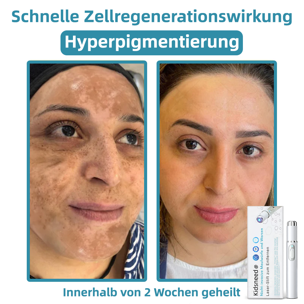 🎁Glückwunsch! Du bist einer unserer glücklichen Gewinner! 💪 Als unser exklusiver Glücksstern erhalten Sie jetzt einen unglaublichen Rabatt von 70%! Verpassen Sie nicht diese einmalige Gelegenheit, sich etwas Besonderes zu gönnen! 🛍️💫