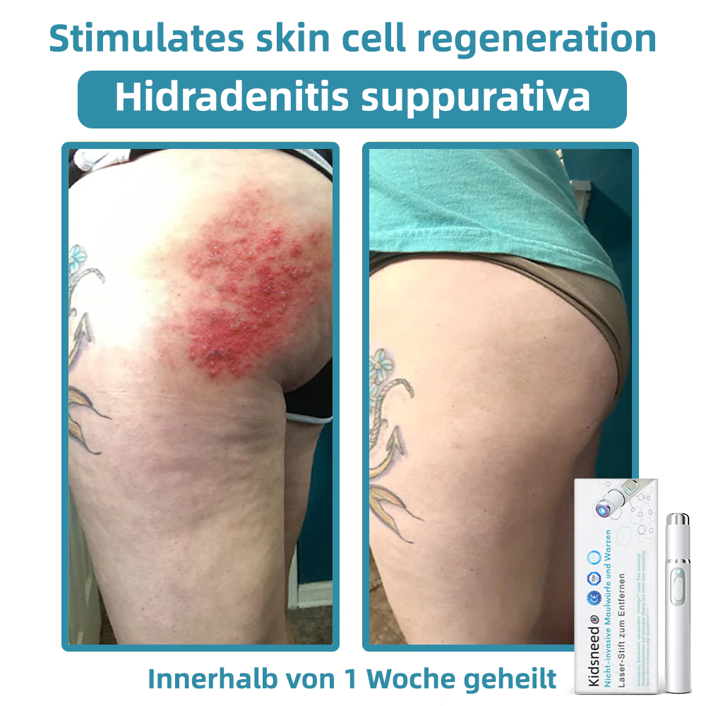 🎁Glückwunsch! Du bist einer unserer glücklichen Gewinner! 💪 Als unser exklusiver Glücksstern erhalten Sie jetzt einen unglaublichen Rabatt von 70%! Verpassen Sie nicht diese einmalige Gelegenheit, sich etwas Besonderes zu gönnen! 🛍️💫