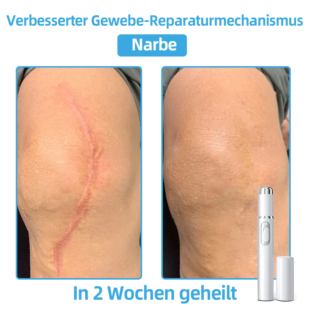 🎁Herzlichen Glückwunsch! 💎Als unser exklusiver Glücksstern erhältst du gerade einen fantastischen Rabatt von 30 %! Verpasse nicht diese einmalige Gelegenheit, dich selbst mit etwas ganz Besonderem zu verwöhnen! 𝑲𝗶𝒅𝘀𝒏𝒆𝒆𝒅® 🛍️💎