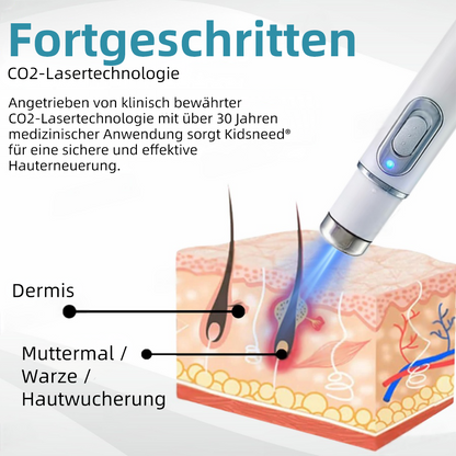 🎁Glückwunsch! Du bist einer unserer glücklichen Gewinner! 💪 Als unser exklusiver Glücksstern erhalten Sie jetzt einen unglaublichen Rabatt von 70%! Verpassen Sie nicht diese einmalige Gelegenheit, sich etwas Besonderes zu gönnen! 🛍️💫
