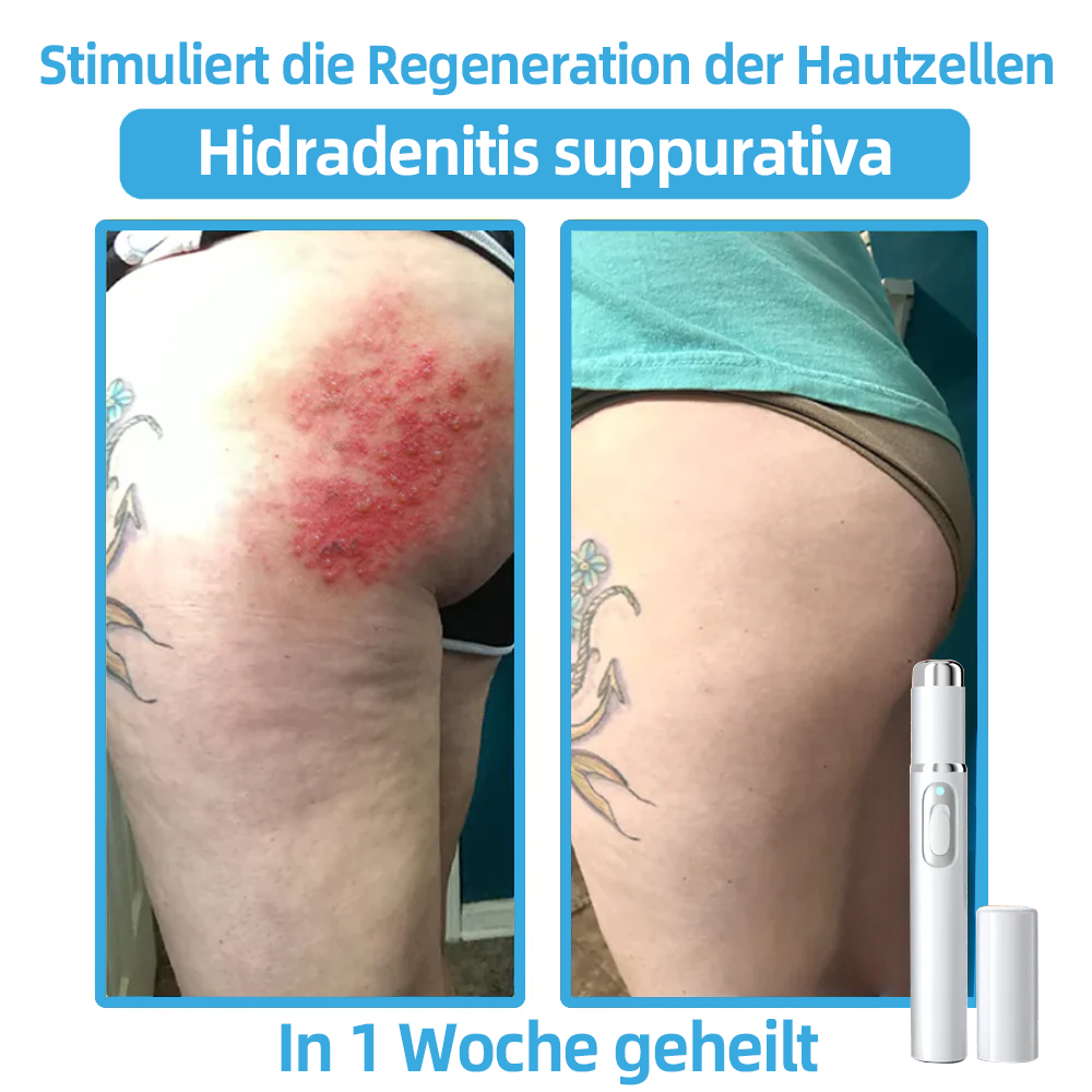 🎁Herzlichen Glückwunsch! 💎Als unser exklusiver Glücksstern erhältst du gerade einen fantastischen Rabatt von 30 %! Verpasse nicht diese einmalige Gelegenheit, dich selbst mit etwas ganz Besonderem zu verwöhnen! 𝑲𝗶𝒅𝘀𝒏𝒆𝒆𝒅® 🛍️💎
