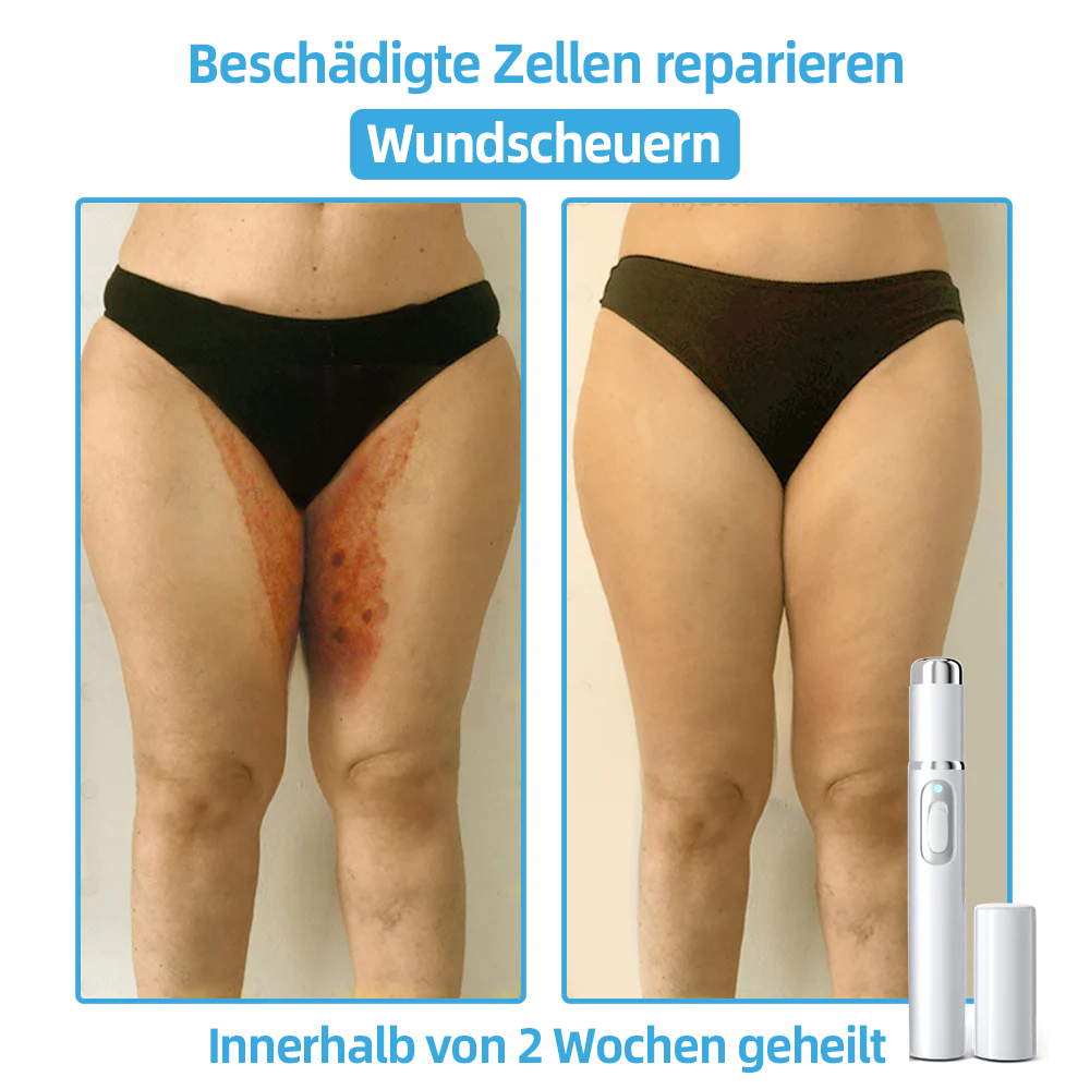 🎁Herzlichen Glückwunsch! 💎Als unser exklusiver Glücksstern erhältst du gerade einen fantastischen Rabatt von 30 %! Verpasse nicht diese einmalige Gelegenheit, dich selbst mit etwas ganz Besonderem zu verwöhnen! 𝑲𝗶𝒅𝘀𝒏𝒆𝒆𝒅® 🛍️💎