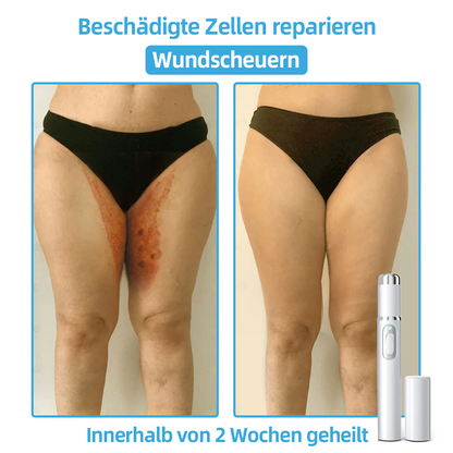 🎁Herzlichen Glückwunsch! 💎Als unser exklusiver Glücksstern erhältst du gerade einen fantastischen Rabatt von 30 %! Verpasse nicht diese einmalige Gelegenheit, dich selbst mit etwas ganz Besonderem zu verwöhnen! 𝑲𝗶𝒅𝘀𝒏𝒆𝒆𝒅® 🛍️💎