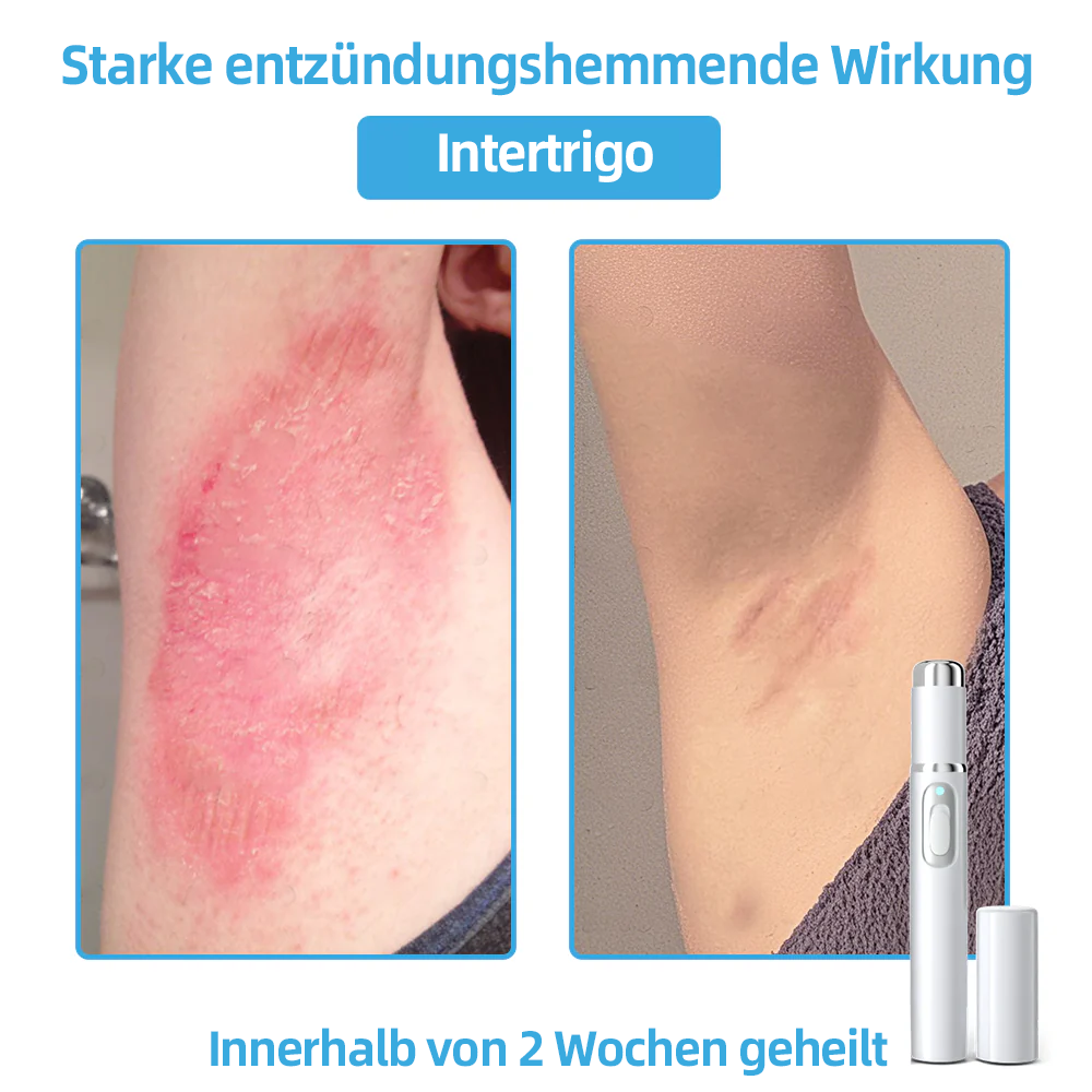 🎁Herzlichen Glückwunsch! 💎Als unser exklusiver Glücksstern erhältst du gerade einen fantastischen Rabatt von 30 %! Verpasse nicht diese einmalige Gelegenheit, dich selbst mit etwas ganz Besonderem zu verwöhnen! 𝑲𝗶𝒅𝘀𝒏𝒆𝒆𝒅® 🛍️💎