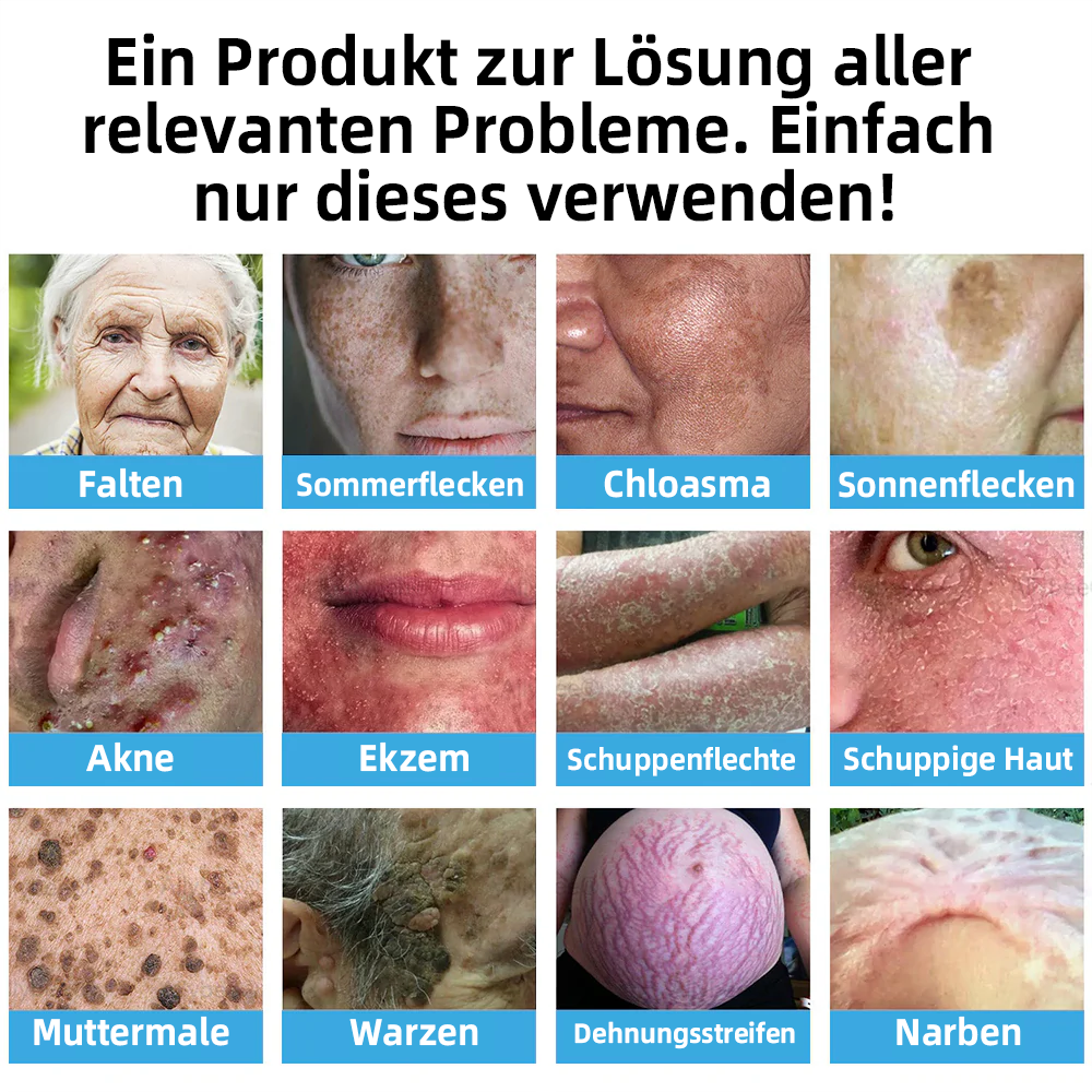 🎁Herzlichen Glückwunsch! 💎Als unser exklusiver Glücksstern erhältst du gerade einen fantastischen Rabatt von 30 %! Verpasse nicht diese einmalige Gelegenheit, dich selbst mit etwas ganz Besonderem zu verwöhnen! 𝑲𝗶𝒅𝘀𝒏𝒆𝒆𝒅® 🛍️💎